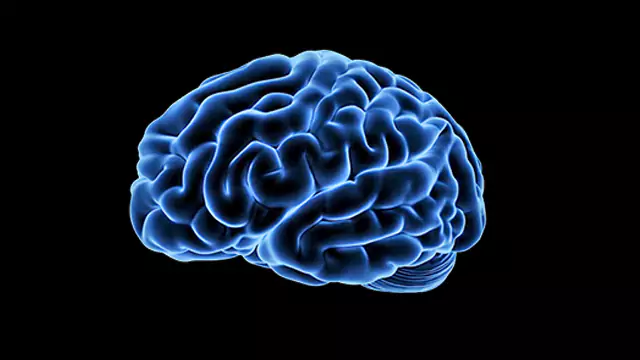 Brain x-ray stock video