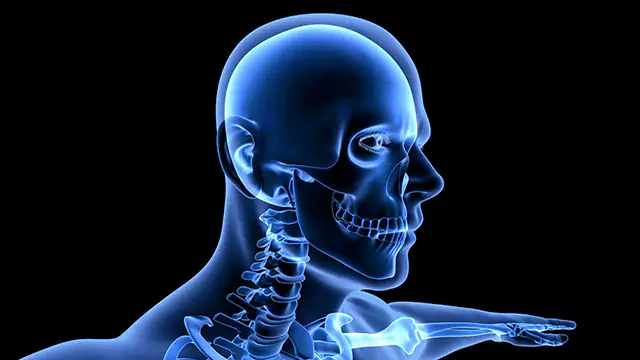 Human head x-ray scan stock video