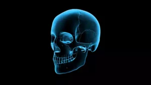 Skull x-ray scan stock video