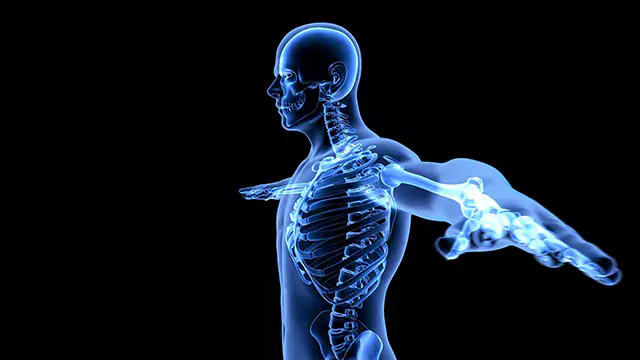 Human body x-ray scan stock video